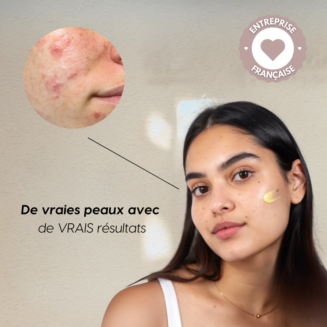 Tumeric Savon Curcuméa™